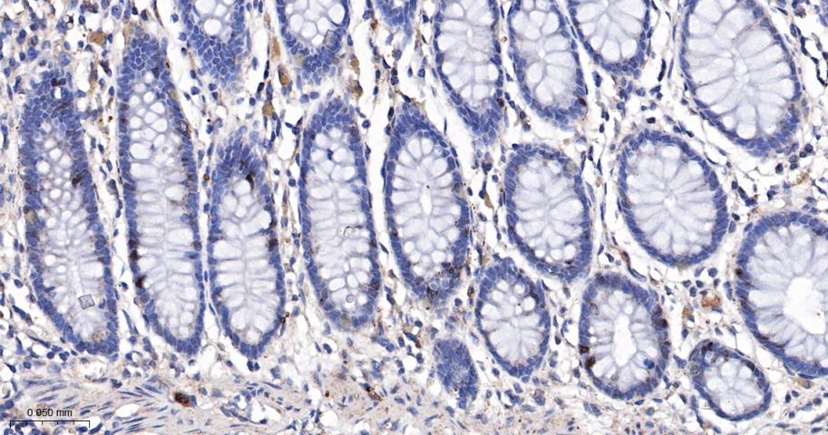 CCNA2 Recombinant Rabbit mAb(b