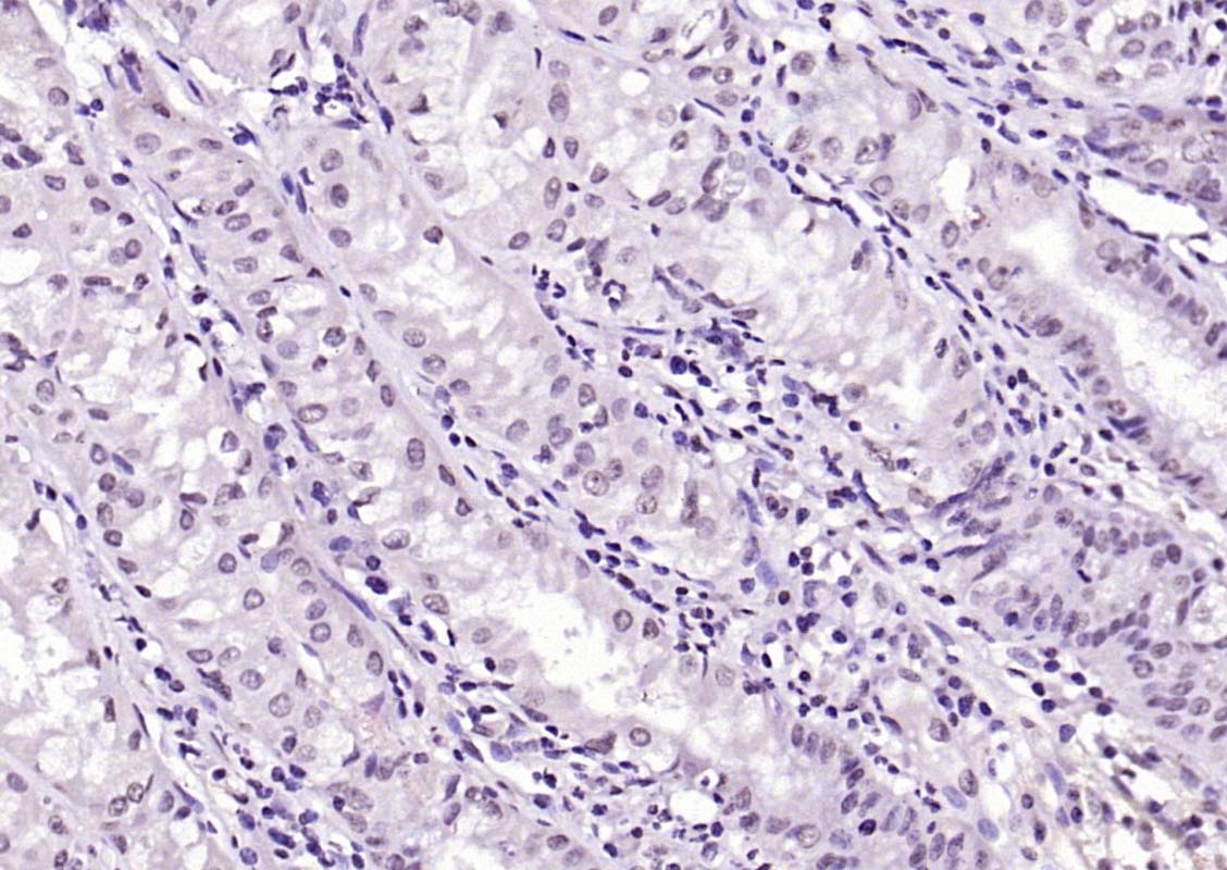 SIK1 Rabbit pAb(bs-6252R)-50ul