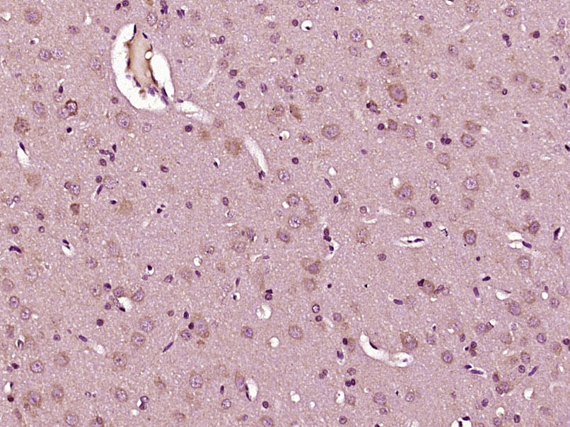 IL23 P19 Rabbit pAb(bs-18146R)