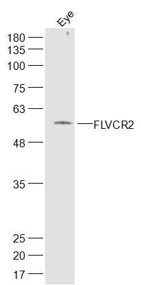 FLVCR2 Rabbit pAb(bs-16147R)-5