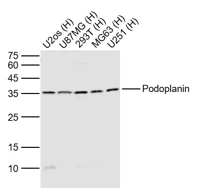 Podoplanin Rabbit pAb(bs-10673