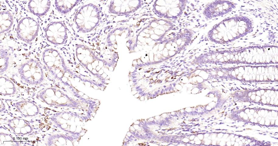 GBA Recombinant Rabbit mAb(bsm