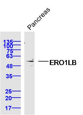 ERO1LB Rabbit pAb(bs-14627R)-5