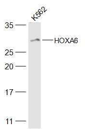 HOXA6 Rabbit pAb(bs-11294R)-50