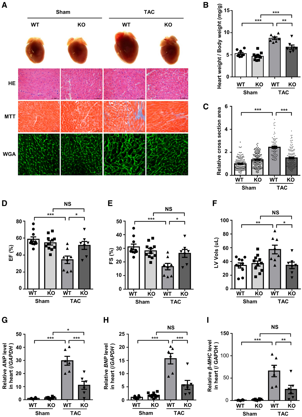 IF=23.603【AAV在心脏疾病中的应用】科学家揭示病理性心肌肥厚及心力衰竭治疗的潜在靶点