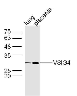 VSIG4 Rabbit pAb(bs-0479R)-50u