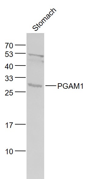 PGAM1 Rabbit pAb(bs-5006R)-50u