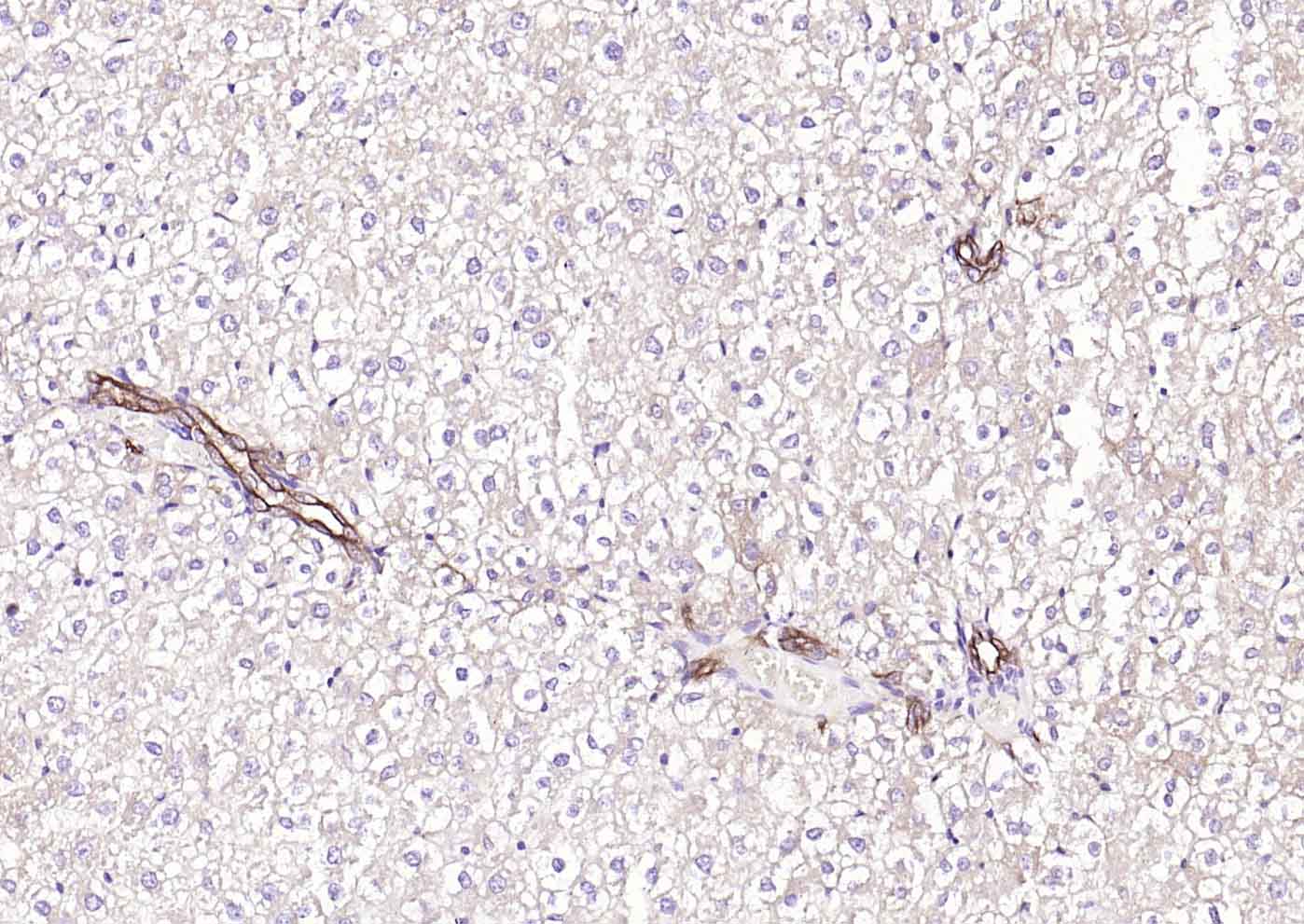 ACVRL1 Rabbit pAb(bs-6020R)-50