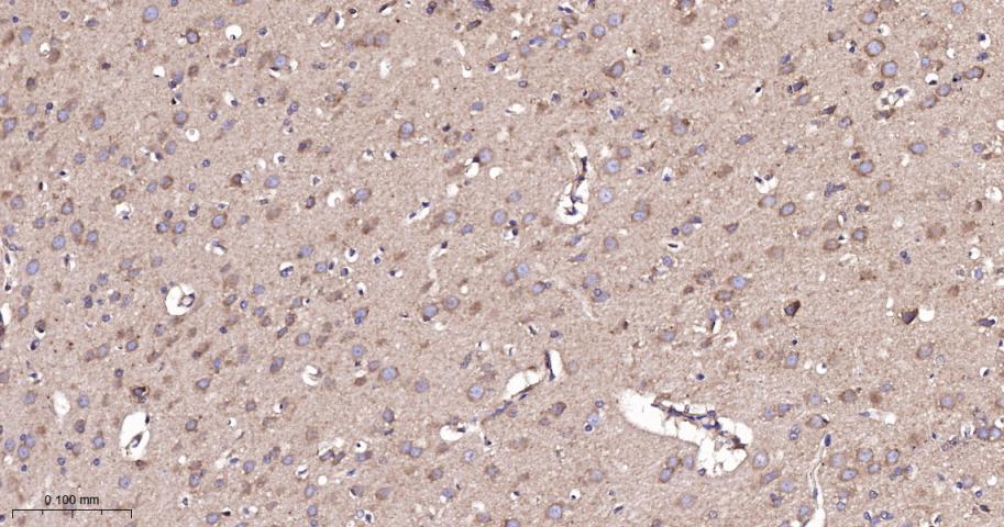 EEF1A1 Recombinant Rabbit mAb(