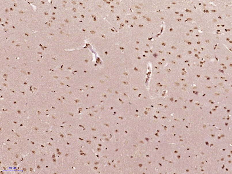 MONDOA Rabbit pAb(bs-18957R)-5