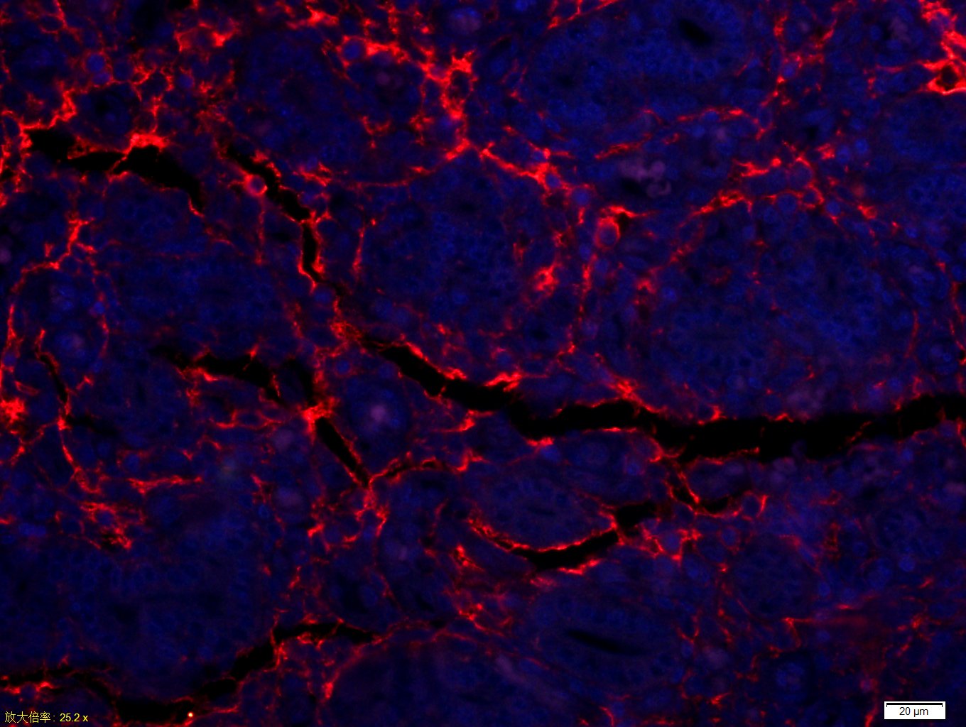 ADGRL4 Rabbit pAb(bs-13111R)-5