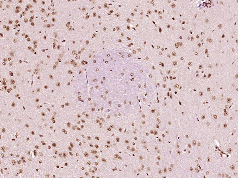 HSF1 Rabbit pAb(bs-3757R)-50ul