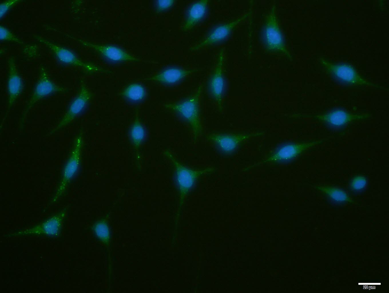 ATG1/ULK1 Rabbit pAb(bs-3602R)