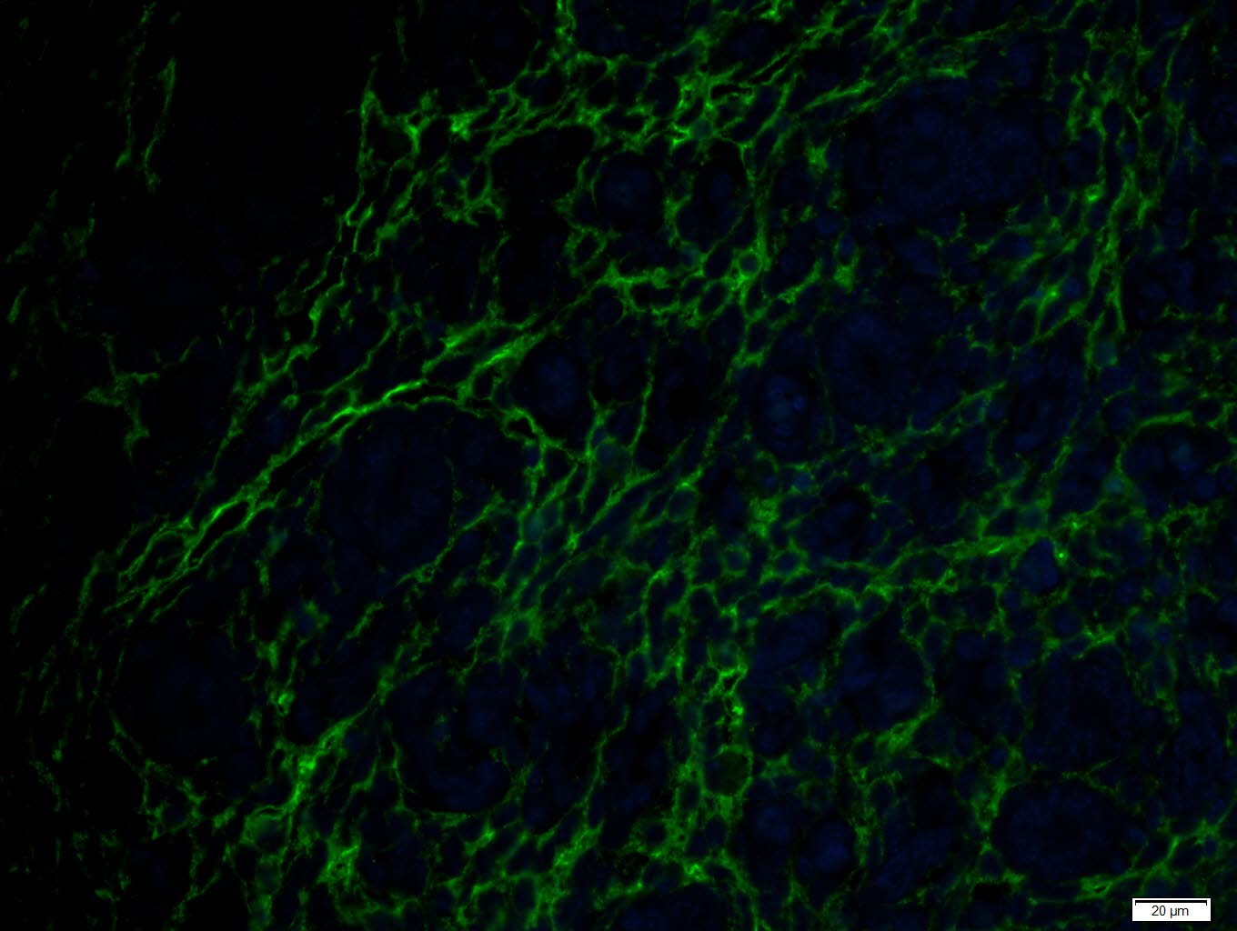 ADGRL4 Rabbit pAb(bs-13111R)-5