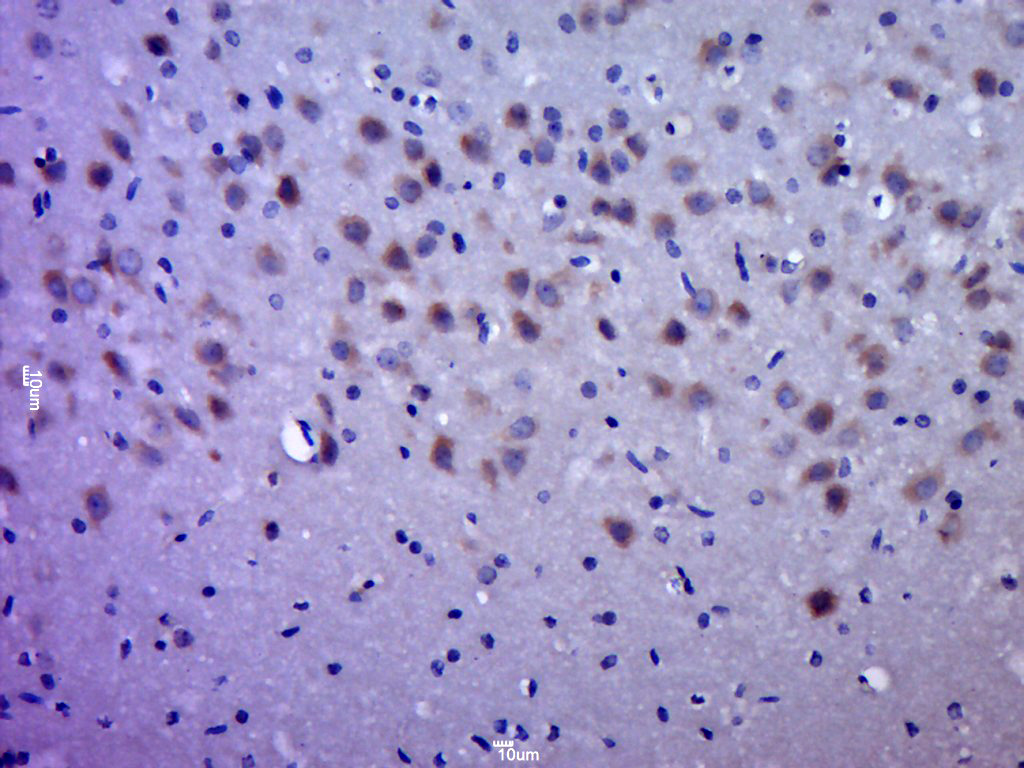 QPRT/QAPRTase Rabbit pAb(bs-20