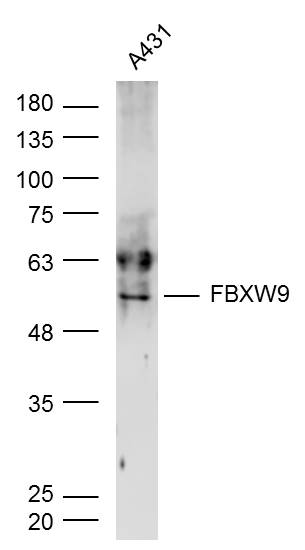 FBXW9 Rabbit pAb(bs-16055R)-50