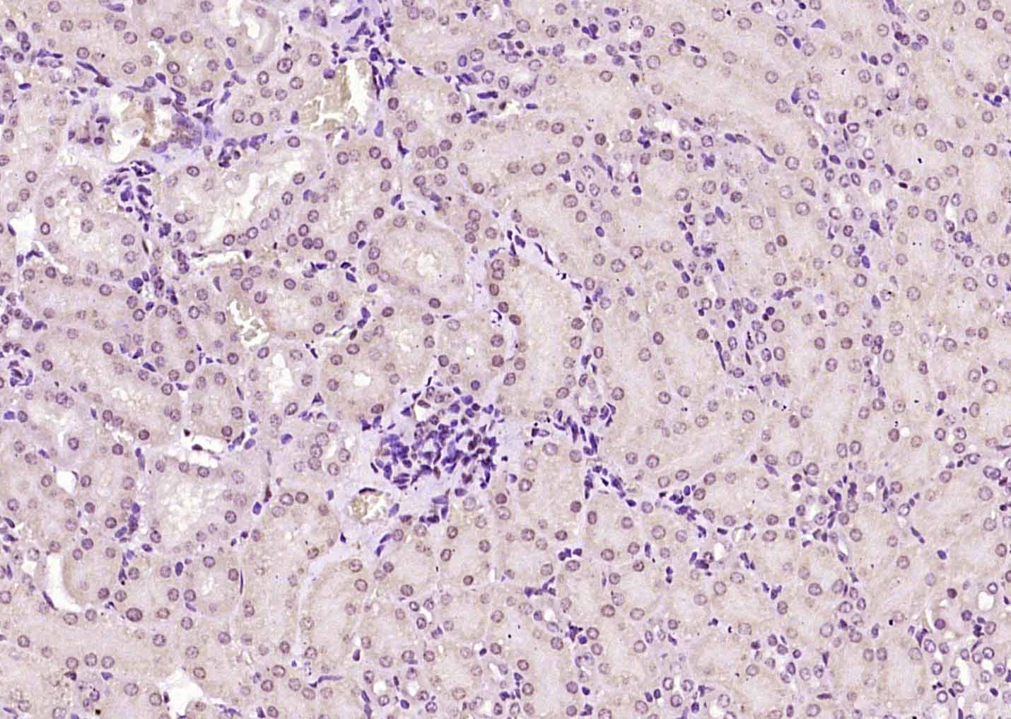 SMARCB1 Rabbit pAb(bs-6109R)-5