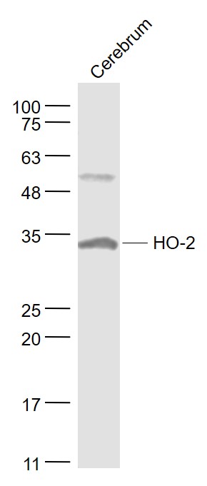 HO-2 Rabbit pAb(bs-1238R)-50ul
