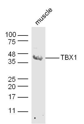 TBX1 Rabbit pAb(bs-8257R)-50ul