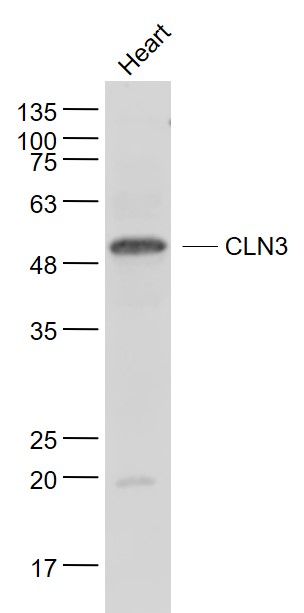 CLN3 Rabbit pAb(bs-8016R)-50ul