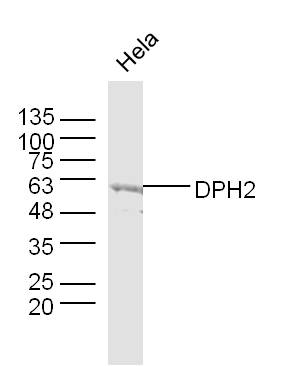 DPH2 Rabbit pAb(bs-8282R)-50ul