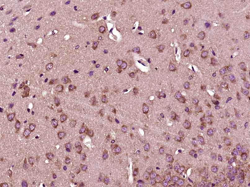 PFKFB3/PFK2 Rabbit pAb(bs-1263