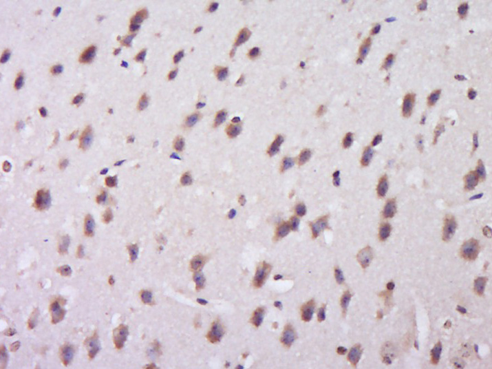 PIK3R2 Rabbit pAb(bs-4160R)-50