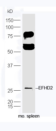 EFHD2 Rabbit pAb(bs-14520R)-50