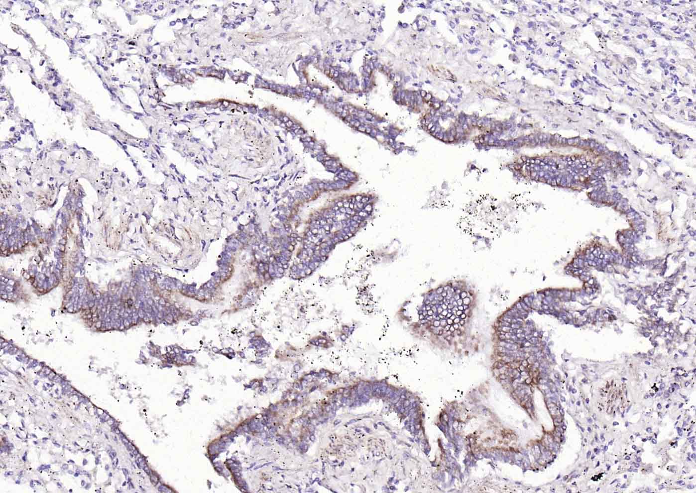 ACVRL1 Rabbit pAb(bs-6020R)-50