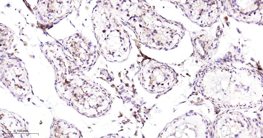 IL13RA1 Recombinant Rabbit mAb