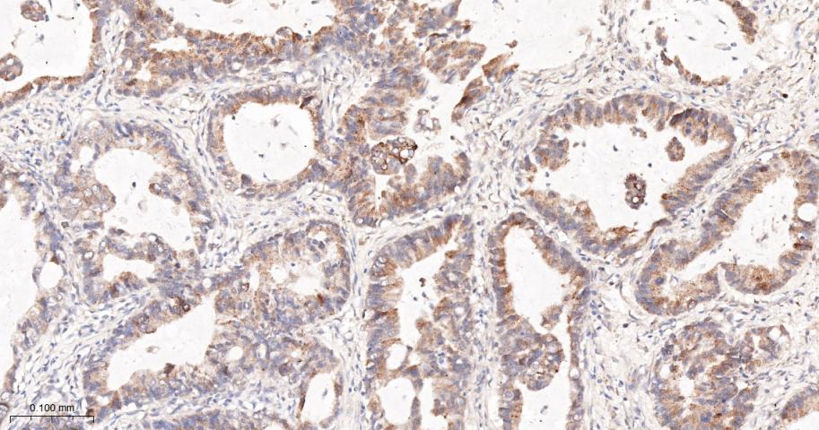 CCNA2 Recombinant Rabbit mAb(b