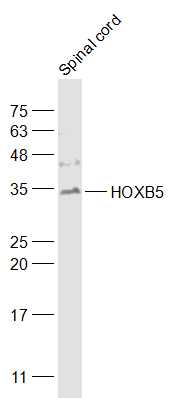 HOXB5 Rabbit pAb(bs-6668R)-50u
