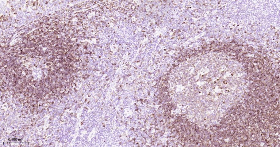 CD79a Mouse mAb(bsm-33449M)-50