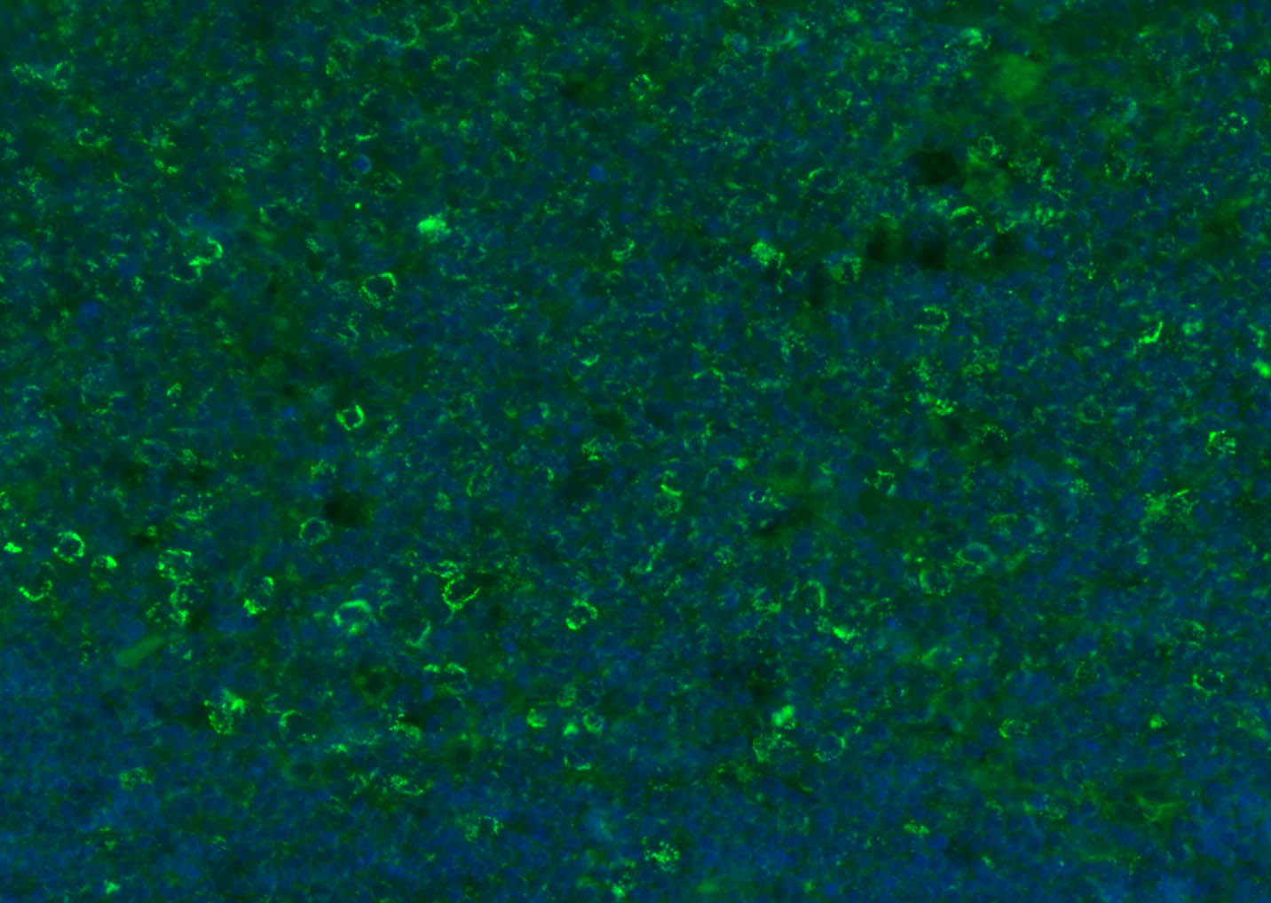 CD8B Rabbit pAb(bs-4914R)-50ul