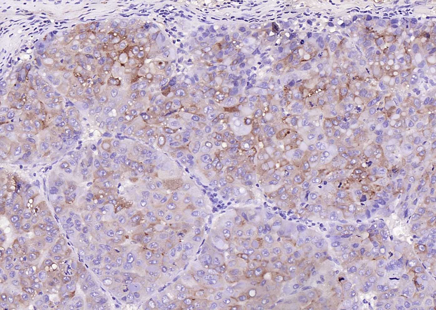 RBP4 Mouse mAb(bsm-43011M)-50u