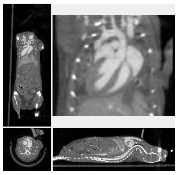 心脏门控成像.png 心脏门控成像.png