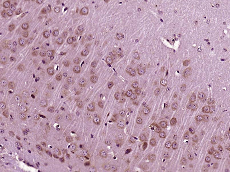 IGF 1 Rabbit pAb(bs-0014R)-50u