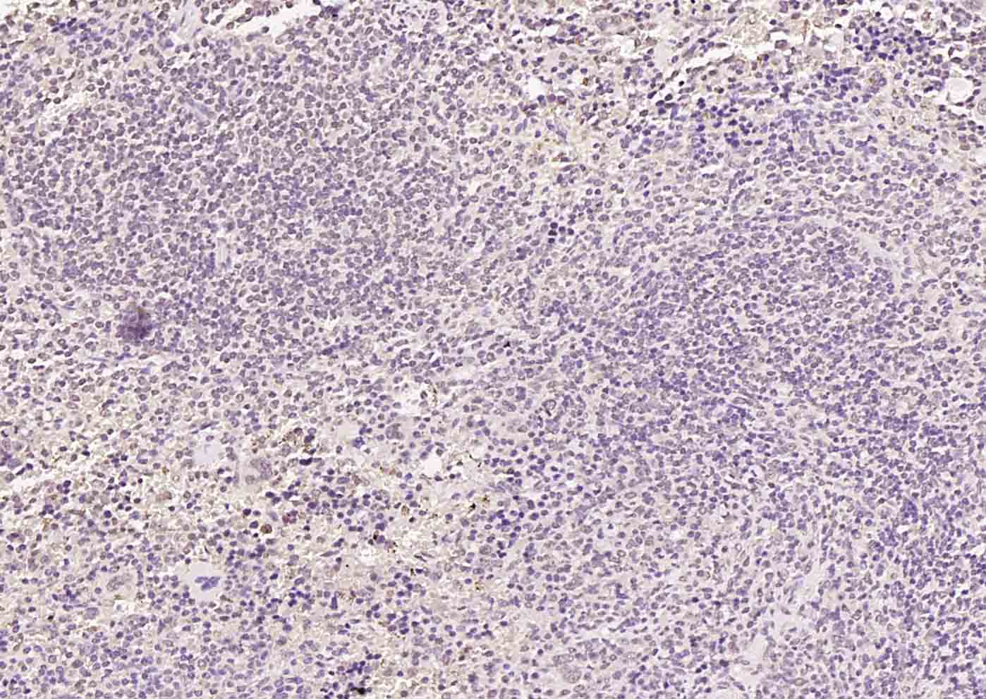 HSF1 Rabbit pAb(bs-3757R)-50ul