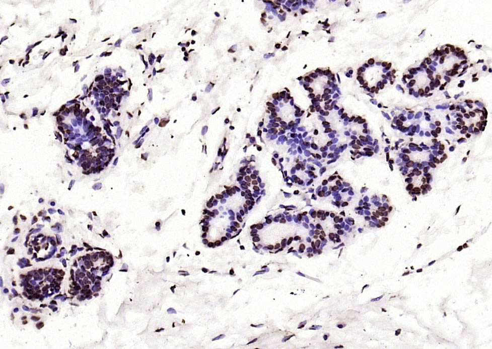 Histone H3(di methyl K27) Mous