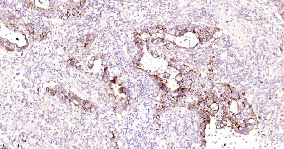 GBA Recombinant Rabbit mAb(bsm
