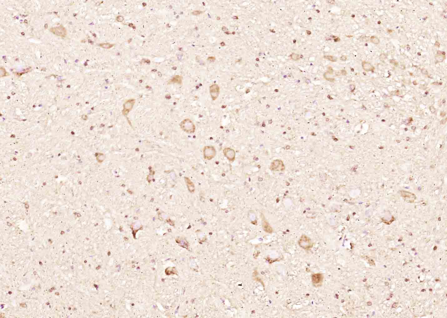 RINT1 Rabbit pAb(bs-7828R)-50u