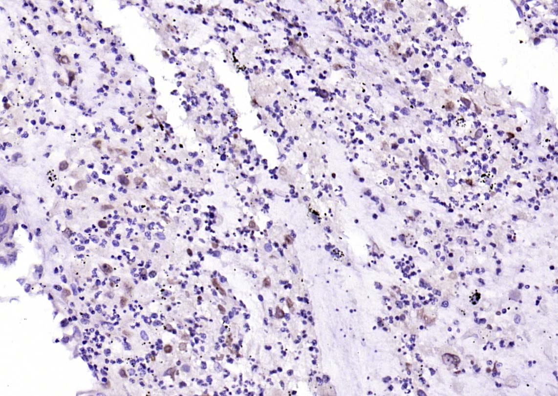 FIGNL1 Rabbit pAb(bs-9433R)-50