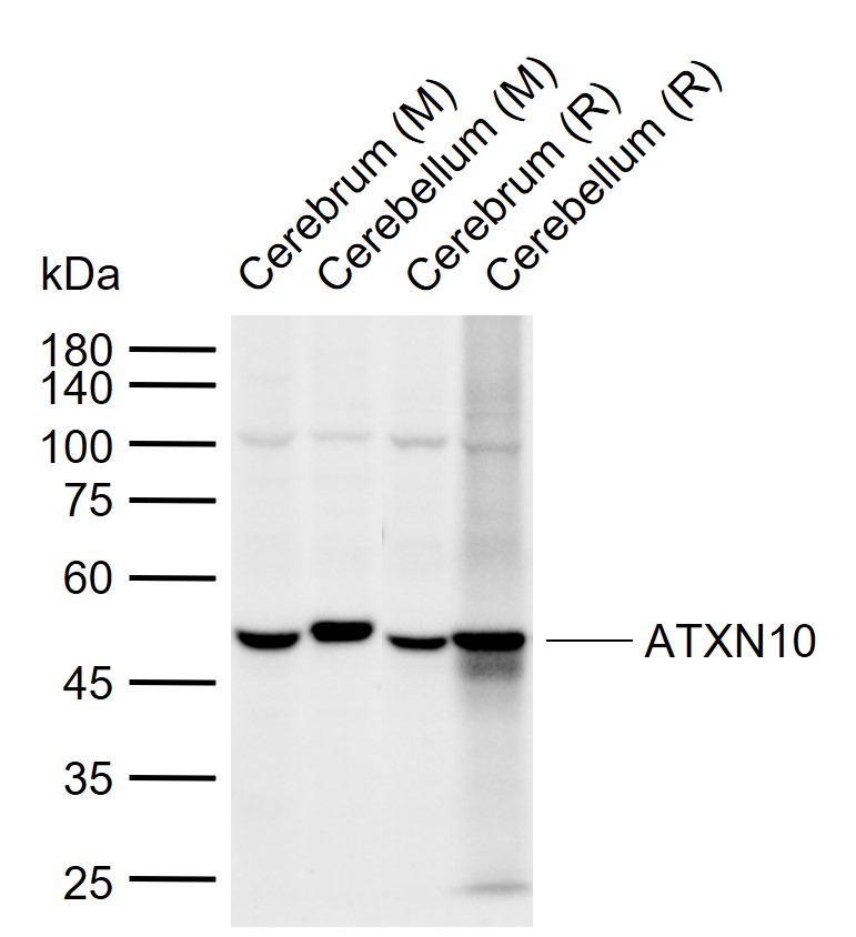 ATXN10 Rabbit pAb(bs-11806R)-5