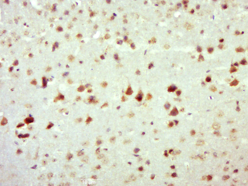 phospho-c-Fos (Ser362) Rabbit