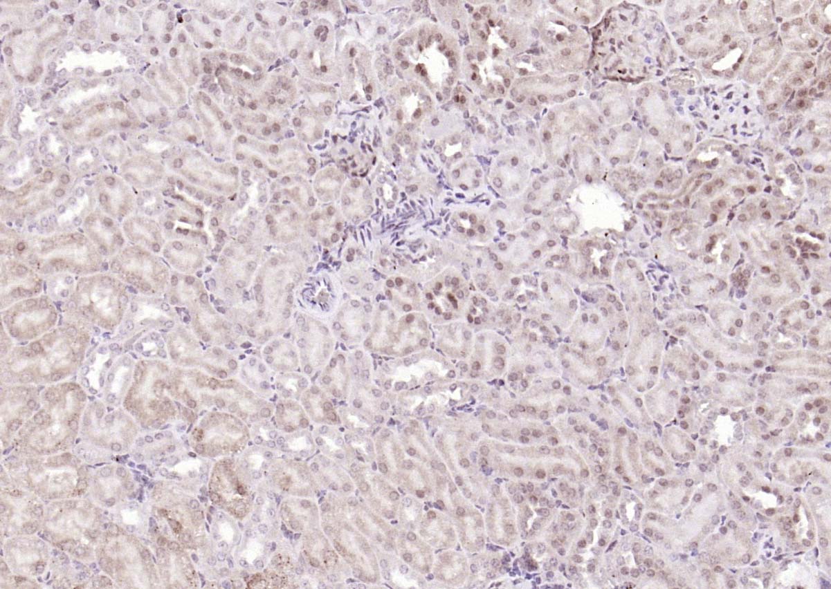 ANKRD54 Rabbit pAb(bs-20549R)-