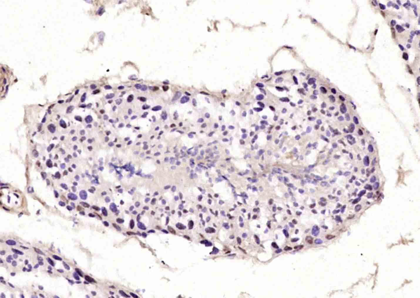 DNTNP Rabbit pAb(bs-11839R)-50