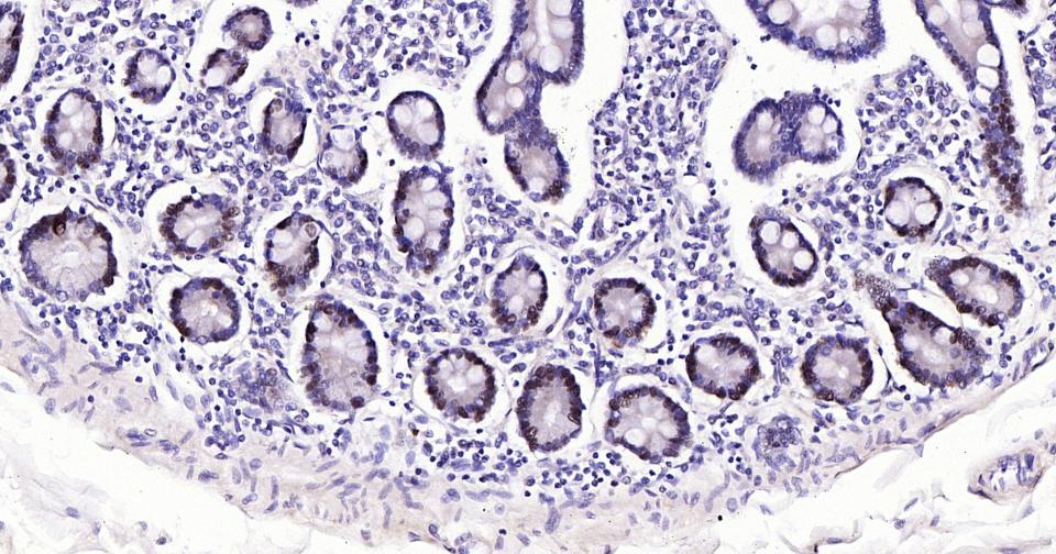 PCNA Rabbit pAb(bs-10889R)-50u