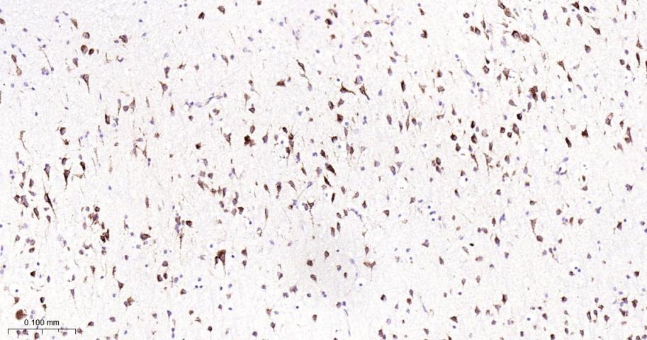 GBA Recombinant Rabbit mAb(bsm