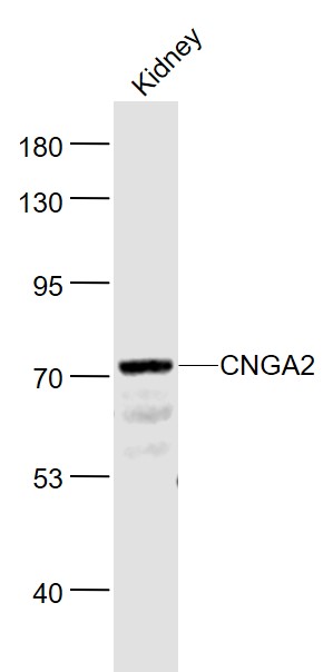 CNGA2 Rabbit pAb(bs-1785R)-50u