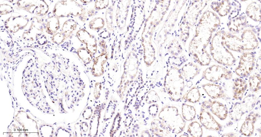 GBA Recombinant Rabbit mAb(bsm